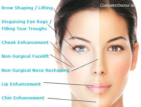 007_dermal-fillers